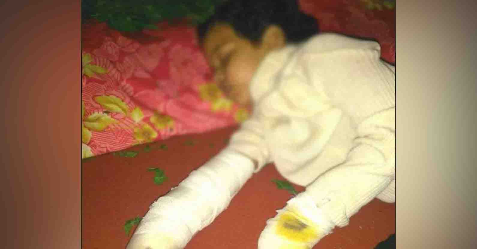 निजी अस्पताल की करतूत: बच्ची का दाहिना हाथ टूटा,अस्पताल ने बाएं हाथ मे प्लास्टर कर दिया